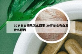 30歲有白癜風(fēng)怎么回事 30歲左右有白發(fā)什么原因