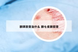 膚琪軟膏治什么 膚七皮膚軟膏
