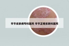 畢節(jié)皮膚病?？漆t(yī)院 畢節(jié)正規(guī)皮膚科醫(yī)院