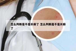怎么判斷是不是長癬了 怎么判斷是不是長癬了