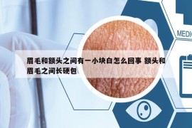 眉毛和額頭之間有一小塊白怎么回事 額頭和眉毛之間長硬包