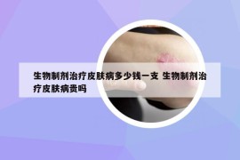 生物制劑治療皮膚病多少錢一支 生物制劑治療皮膚病貴嗎