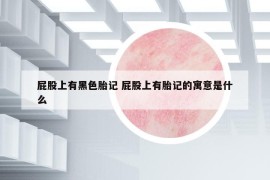 屁股上有黑色胎記 屁股上有胎記的寓意是什么