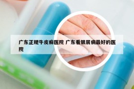 廣東正規(guī)牛皮癬醫(yī)院 廣東看銀屑病最好的醫(yī)院
