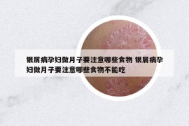 銀屑病孕婦做月子要注意哪些食物 銀屑病孕婦做月子要注意哪些食物不能吃