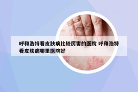 呼和浩特看皮膚病比較厲害的醫(yī)院 呼和浩特看皮膚病哪里醫(yī)院好