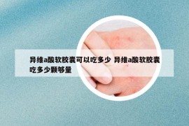 異維a酸軟膠囊可以吃多少 異維a酸軟膠囊吃多少顆夠量