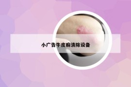 小廣告牛皮癬清除設(shè)備