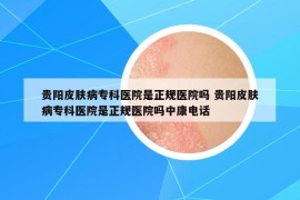 貴陽皮膚病專科醫(yī)院是正規(guī)醫(yī)院嗎 貴陽皮膚病?？漆t(yī)院是正規(guī)醫(yī)院嗎中康電話