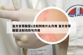 復(fù)方甘草酸苷s注射劑有什么作用 復(fù)方甘草酸苷注射功效與作用