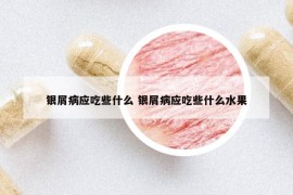 銀屑病應(yīng)吃些什么 銀屑病應(yīng)吃些什么水果