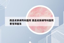 西昌皮膚病?？漆t(yī)院 西昌皮膚病專科醫(yī)院 曹雪萍醫(yī)生