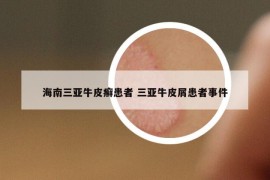 海南三亞牛皮癬患者 三亞牛皮屑患者事件