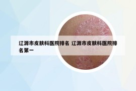 遼源市皮膚科醫(yī)院排名 遼源市皮膚科醫(yī)院排名第一