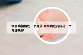 銀屑病初期吃一個(gè)月藥 銀屑病吃藥抹藥一個(gè)月還未好