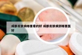 成都皮膚病哪里看的好 成都皮膚病到哪里醫(yī)好