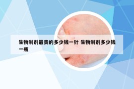 生物制劑最貴的多少錢一針 生物制劑多少錢一瓶