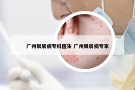 廣州銀屑病專科醫(yī)生 廣州銀屑病專家