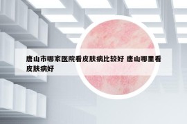 唐山市哪家醫(yī)院看皮膚病比較好 唐山哪里看皮膚病好
