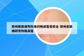 鄭州銀屑病?？苼韱枟钍缟彴郯踩?鄭州皮膚病研究所楊淑蓮
