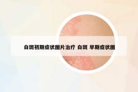 白斑初期癥狀圖片治療 白斑 早期癥狀圖