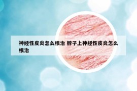 神經(jīng)性皮炎怎么根治 脖子上神經(jīng)性皮炎怎么根治