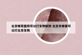 北京哪家醫(yī)院可以打生物制劑 北京市哪里可以打北京生物