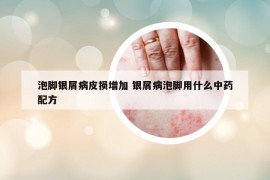 泡腳銀屑病皮損增加 銀屑病泡腳用什么中藥配方