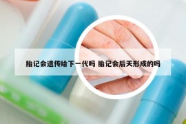 胎記會遺傳給下一代嗎 胎記會后天形成的嗎
