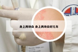 身上兩塊白 身上兩塊白好幾年