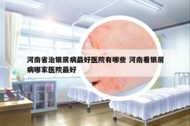 河南省治銀屑病最好醫(yī)院有哪些 河南看銀屑病哪家醫(yī)院最好