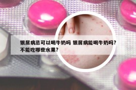 銀屑病忌可以喝牛奶嗎 銀屑病能喝牛奶嗎?不能吃哪些水果?