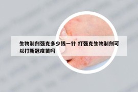 生物制劑強(qiáng)克多少錢(qián)一針 打強(qiáng)克生物制劑可以打新冠疫苗嗎