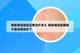 銀屑病消退后還要治療多久 銀屑病消退期是不是說明快好了