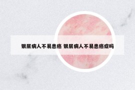 銀屑病人不易患癌 銀屑病人不易患癌癥嗎