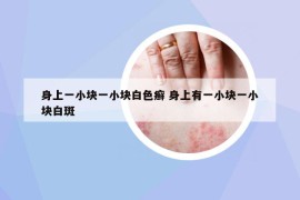 身上一小塊一小塊白色癬 身上有一小塊一小塊白斑