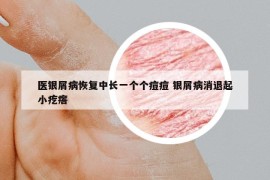 醫(yī)銀屑病恢復中長一個個痘痘 銀屑病消退起小疙瘩