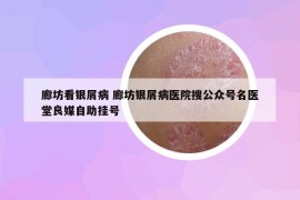 廊坊看銀屑病 廊坊銀屑病醫(yī)院搜公眾號(hào)名醫(yī)堂良媒自助掛號(hào)