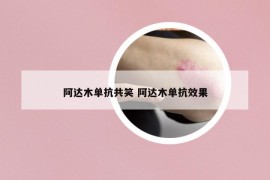 阿達(dá)木單抗共笑 阿達(dá)木單抗效果