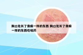 胸口處長了像癬一樣的東西 胸口處長了像癬一樣的東西吃啥藥