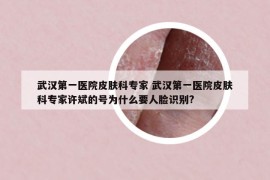 武漢第一醫(yī)院皮膚科專家 武漢第一醫(yī)院皮膚科專家許斌的號為什么要人臉識別?