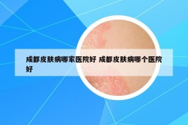 成都皮膚病哪家醫(yī)院好 成都皮膚病哪個醫(yī)院好