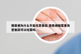 銀屑病為什么不能吃蔥姜蒜 銀屑病做菜里有蔥姜蒜可以吃菜嗎