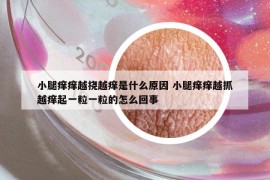 小腿癢癢越撓越癢是什么原因 小腿癢癢越抓越癢起一粒一粒的怎么回事