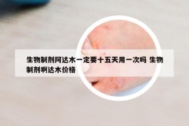 生物制劑阿達(dá)木一定要十五天用一次嗎 生物制劑啊達(dá)木價(jià)格
