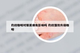 豹紋咖啡對銀屑病有影響嗎 豹紋強效升級咖啡