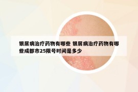 銀屑病治療藥物有哪些 銀屑病治療藥物有哪些成都市25限號時間是多少