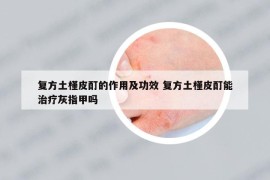 復方土槿皮酊的作用及功效 復方土槿皮酊能治療灰指甲嗎