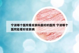 寧波哪個醫(yī)院看皮膚科最好的醫(yī)院 寧波哪個醫(yī)院能看好皮膚病