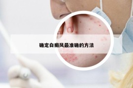 確定白癜風(fēng)最準(zhǔn)確的方法